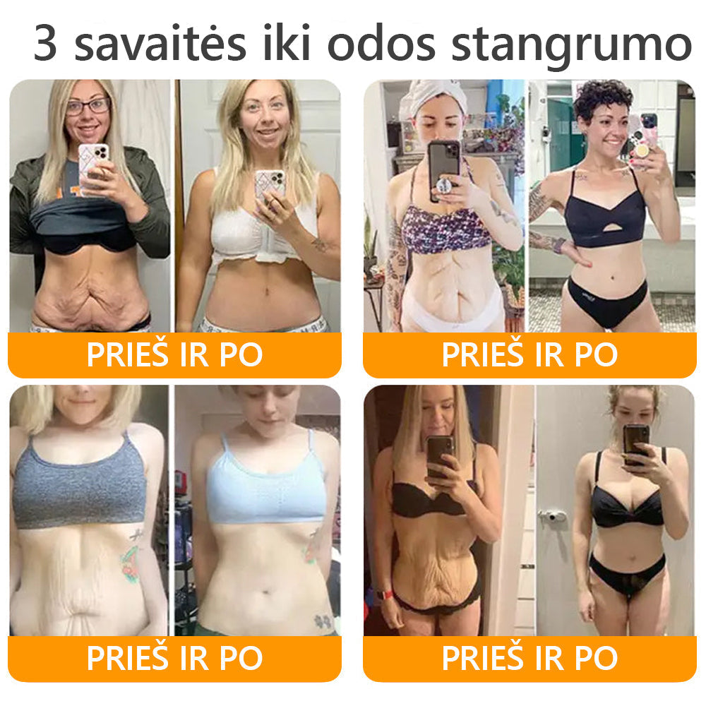 𝖠𝖯𝖪𝖠𝖯𝖪® 🐝 Kremas su bičių nuodu odos atstatymui 🐝 padeda spręsti odos problemas, tokias kaip: raukšlės, randai, pigmentinės dėmės, strijos, spuogai, psoriazė, egzema, odos pažeidimai, dirginimas, uždegimai ir kiti odos sutrikimai.