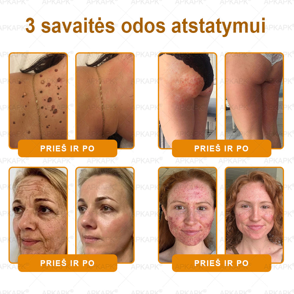 𝖠𝖯𝖪𝖠𝖯𝖪® 🐝 Kremas su bičių nuodu odos atstatymui 🐝 padeda spręsti odos problemas, tokias kaip: raukšlės, randai, pigmentinės dėmės, strijos, spuogai, psoriazė, egzema, odos pažeidimai, dirginimas, uždegimai ir kiti odos sutrikimai.