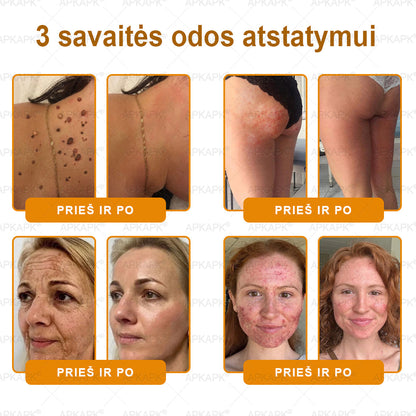𝖠𝖯𝖪𝖠𝖯𝖪® 🐝 Kremas su bičių nuodu odos atstatymui 🐝 padeda spręsti odos problemas, tokias kaip: raukšlės, randai, pigmentinės dėmės, strijos, spuogai, psoriazė, egzema, odos pažeidimai, dirginimas, uždegimai ir kiti odos sutrikimai.