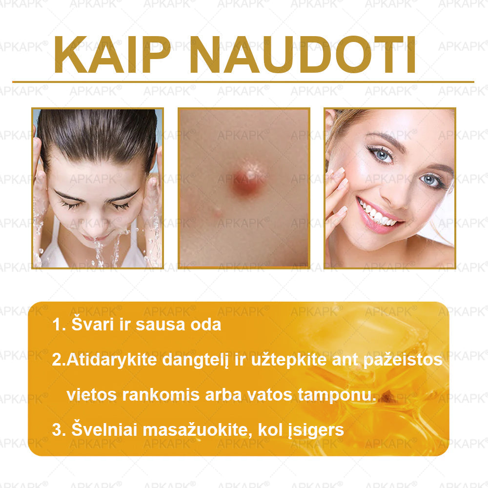 𝖠𝖯𝖪𝖠𝖯𝖪® 🐝 Kremas su bičių nuodu odos atstatymui 🐝 padeda spręsti odos problemas, tokias kaip: raukšlės, randai, pigmentinės dėmės, strijos, spuogai, psoriazė, egzema, odos pažeidimai, dirginimas, uždegimai ir kiti odos sutrikimai.