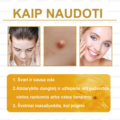 𝖠𝖯𝖪𝖠𝖯𝖪® 🐝 Kremas su bičių nuodu odos atstatymui 🐝 padeda spręsti odos problemas, tokias kaip: raukšlės, randai, pigmentinės dėmės, strijos, spuogai, psoriazė, egzema, odos pažeidimai, dirginimas, uždegimai ir kiti odos sutrikimai.