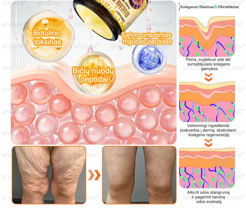 𝖠𝖯𝖪𝖠𝖯𝖪® 🐝 Kremas su bičių nuodu odos atstatymui 🐝 padeda spręsti odos problemas, tokias kaip: raukšlės, randai, pigmentinės dėmės, strijos, spuogai, psoriazė, egzema, odos pažeidimai, dirginimas, uždegimai ir kiti odos sutrikimai.