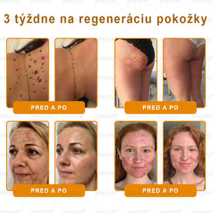 Vyrobené a odoslané zo Slovenska ✨✨𝖠𝖯𝖪𝖠𝖯𝖪® 𝖡𝖾𝖾 𝗏𝖾𝗇𝗈𝗆 𝖪𝗋𝖾𝗆 𝗇𝖺 𝗈𝗉𝗋𝖺𝗏𝗎 𝗉𝗅𝖾𝗍𝗂