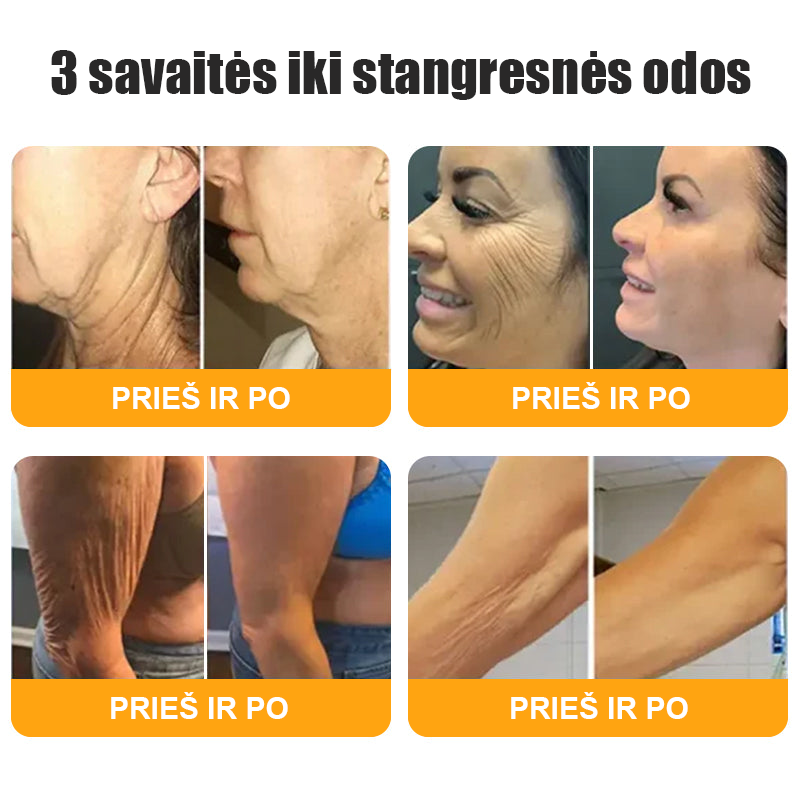 𝖠𝖯𝖪𝖠𝖯𝖪® 🐝 Kremas su bičių nuodu odos atstatymui 🐝 padeda spręsti odos problemas, tokias kaip: raukšlės, randai, pigmentinės dėmės, strijos, spuogai, psoriazė, egzema, odos pažeidimai, dirginimas, uždegimai ir kiti odos sutrikimai.