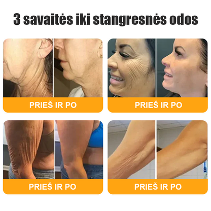 𝖠𝖯𝖪𝖠𝖯𝖪® 🐝 Kremas su bičių nuodu odos atstatymui 🐝 padeda spręsti odos problemas, tokias kaip: raukšlės, randai, pigmentinės dėmės, strijos, spuogai, psoriazė, egzema, odos pažeidimai, dirginimas, uždegimai ir kiti odos sutrikimai.