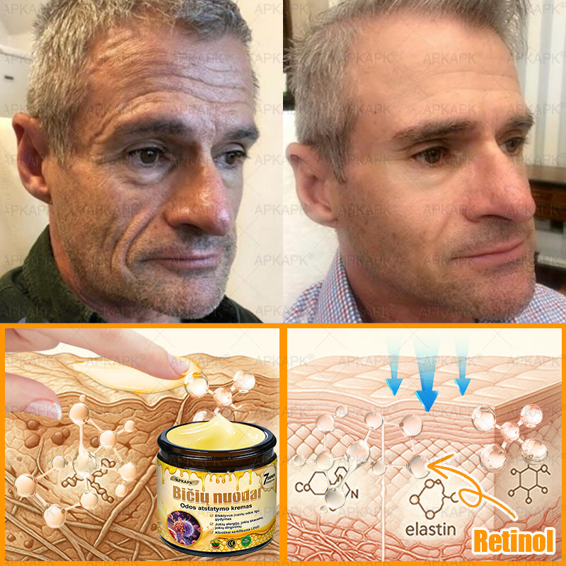 𝖠𝖯𝖪𝖠𝖯𝖪® 🐝 Kremas su bičių nuodu odos atstatymui 🐝 padeda spręsti odos problemas, tokias kaip: raukšlės, randai, pigmentinės dėmės, strijos, spuogai, psoriazė, egzema, odos pažeidimai, dirginimas, uždegimai ir kiti odos sutrikimai.