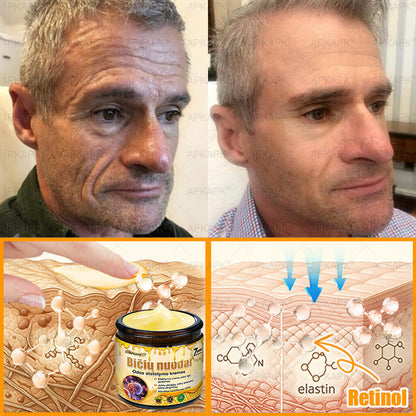 𝖠𝖯𝖪𝖠𝖯𝖪® 🐝 Kremas su bičių nuodu odos atstatymui 🐝 padeda spręsti odos problemas, tokias kaip: raukšlės, randai, pigmentinės dėmės, strijos, spuogai, psoriazė, egzema, odos pažeidimai, dirginimas, uždegimai ir kiti odos sutrikimai.