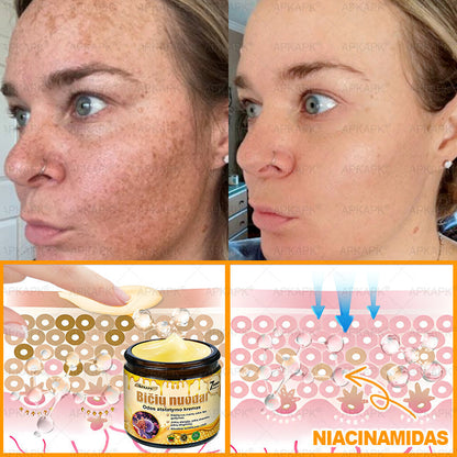 𝖠𝖯𝖪𝖠𝖯𝖪® 🐝 Kremas su bičių nuodu odos atstatymui 🐝 padeda spręsti odos problemas, tokias kaip: raukšlės, randai, pigmentinės dėmės, strijos, spuogai, psoriazė, egzema, odos pažeidimai, dirginimas, uždegimai ir kiti odos sutrikimai.