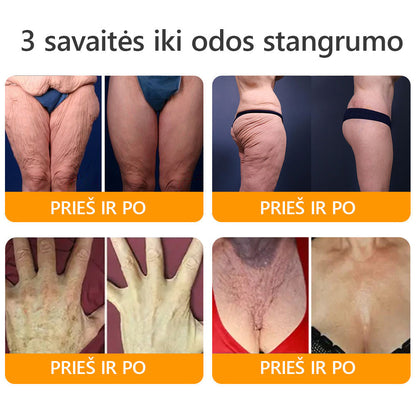 𝖠𝖯𝖪𝖠𝖯𝖪® 🐝 Kremas su bičių nuodu odos atstatymui 🐝 padeda spręsti odos problemas, tokias kaip: raukšlės, randai, pigmentinės dėmės, strijos, spuogai, psoriazė, egzema, odos pažeidimai, dirginimas, uždegimai ir kiti odos sutrikimai.