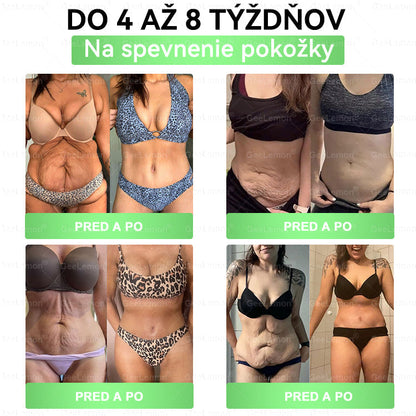 🎁 Zostáva už len 5 balení! Teraz získate extra 50 % zľavu! Buďte zdraví a vo forme. Ak túto príležitosť nevyužijete teraz, ďalšia šanca bude až budúci rok!