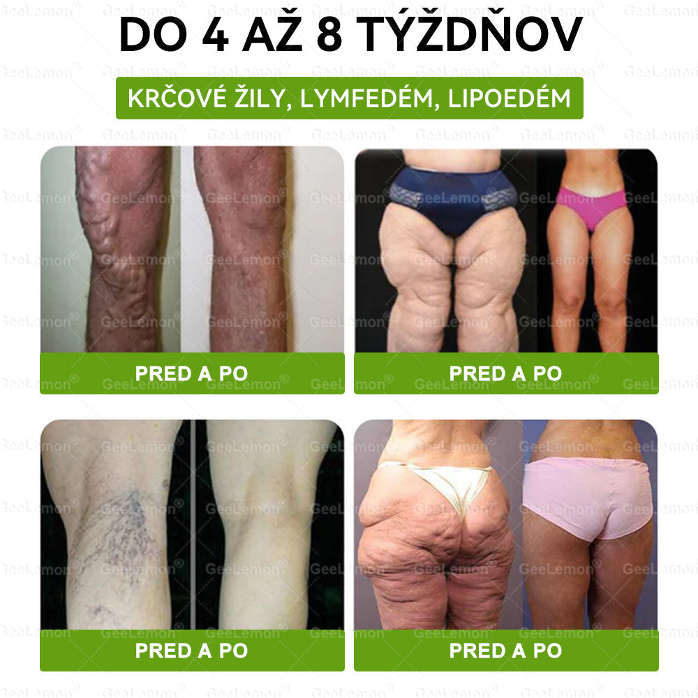 🎁 Zostáva už len 5 balení! Teraz získate extra 50 % zľavu! Buďte zdraví a vo forme. Ak túto príležitosť nevyužijete teraz, ďalšia šanca bude až budúci rok!